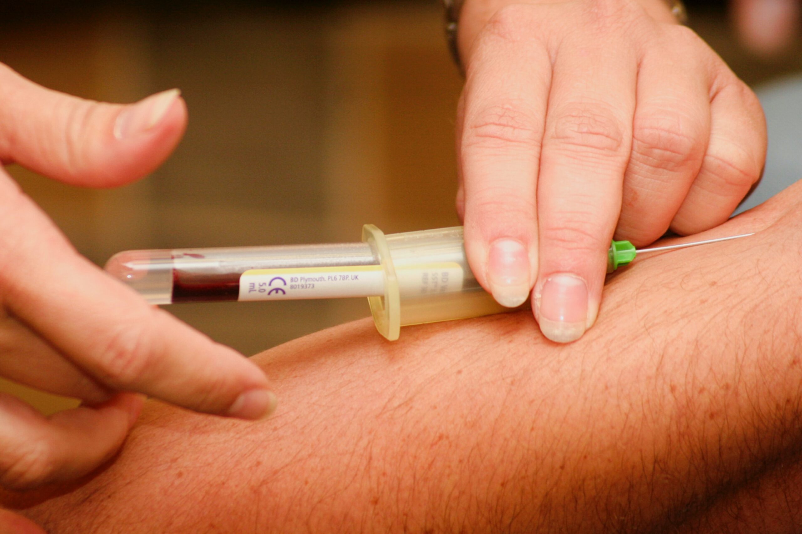 woman drawing blood from patient